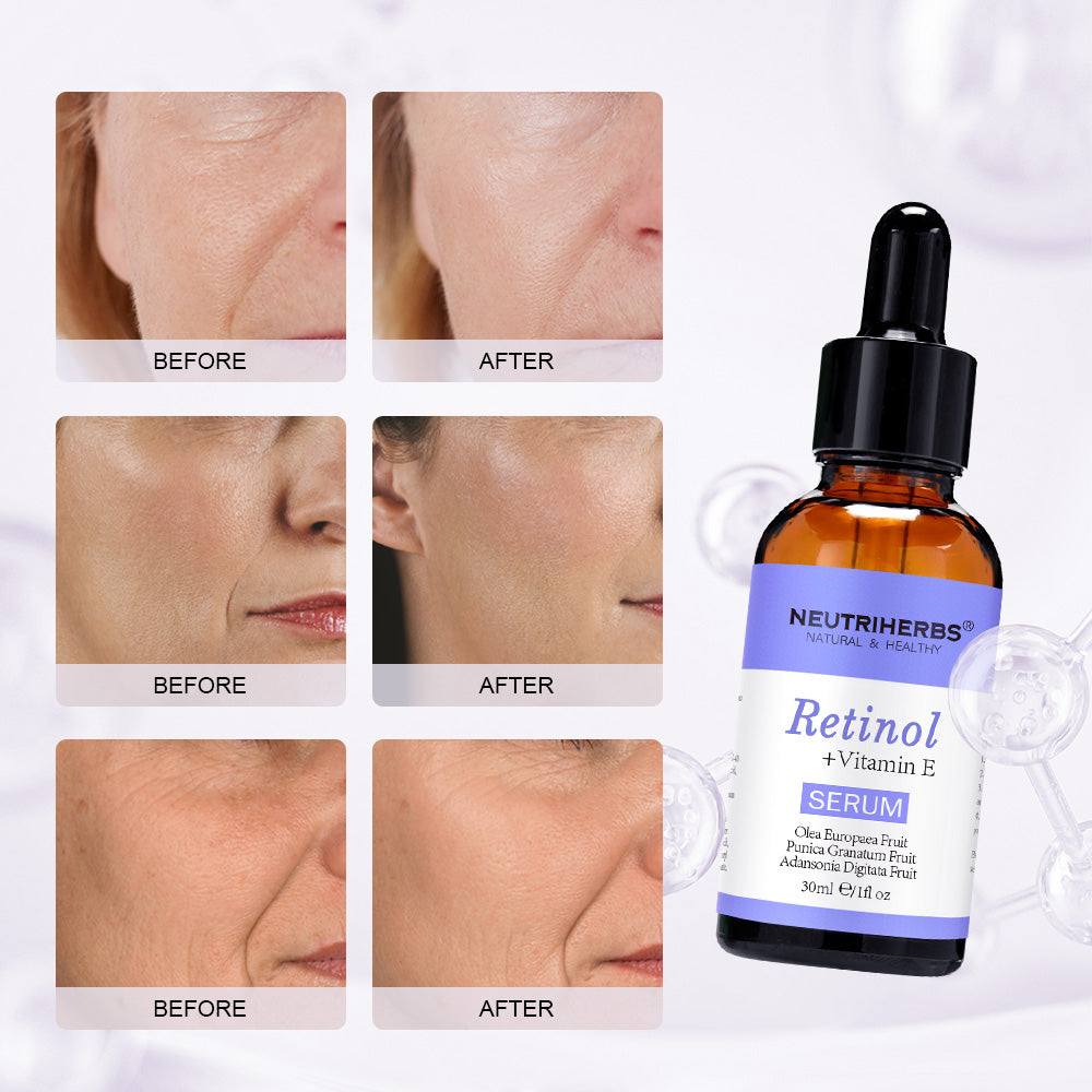 Retinol Serum – wygładzające serum z retinolem i witaminą E