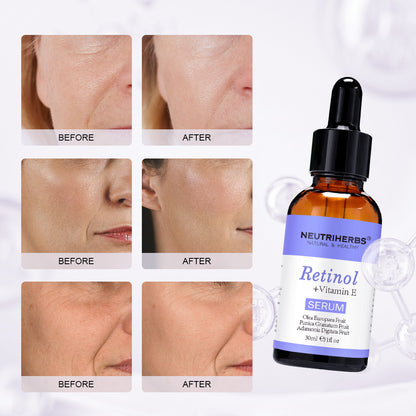 Retinol Serum – wygładzające serum z retinolem i witaminą E