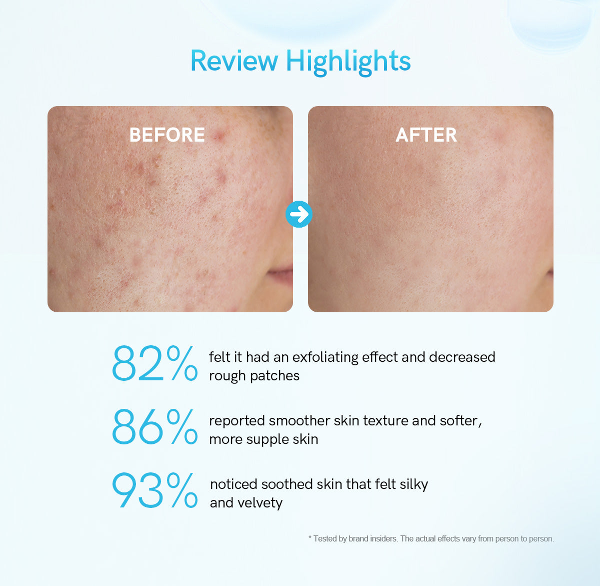 Salicylic Acid Exfoliating Serum – złuszczające serum z kwasem salicylowym 2% i niacynamidem