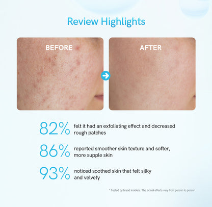 Salicylic Acid Exfoliating Serum – złuszczające serum z kwasem salicylowym 2% i niacynamidem